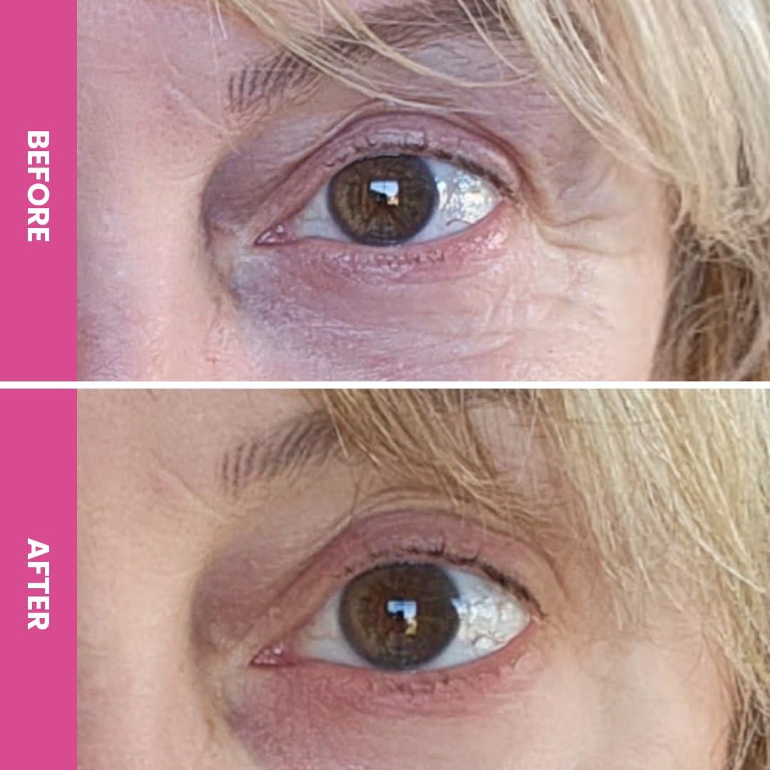 image:imagePRIME PROMETICS PrimeEyes Hydrate Under Eye Cream for Mature Women Hydrating Eye Cream for Dark Circles and Wrinkle Repair Soft Glowing amp Healthy Under Eyes