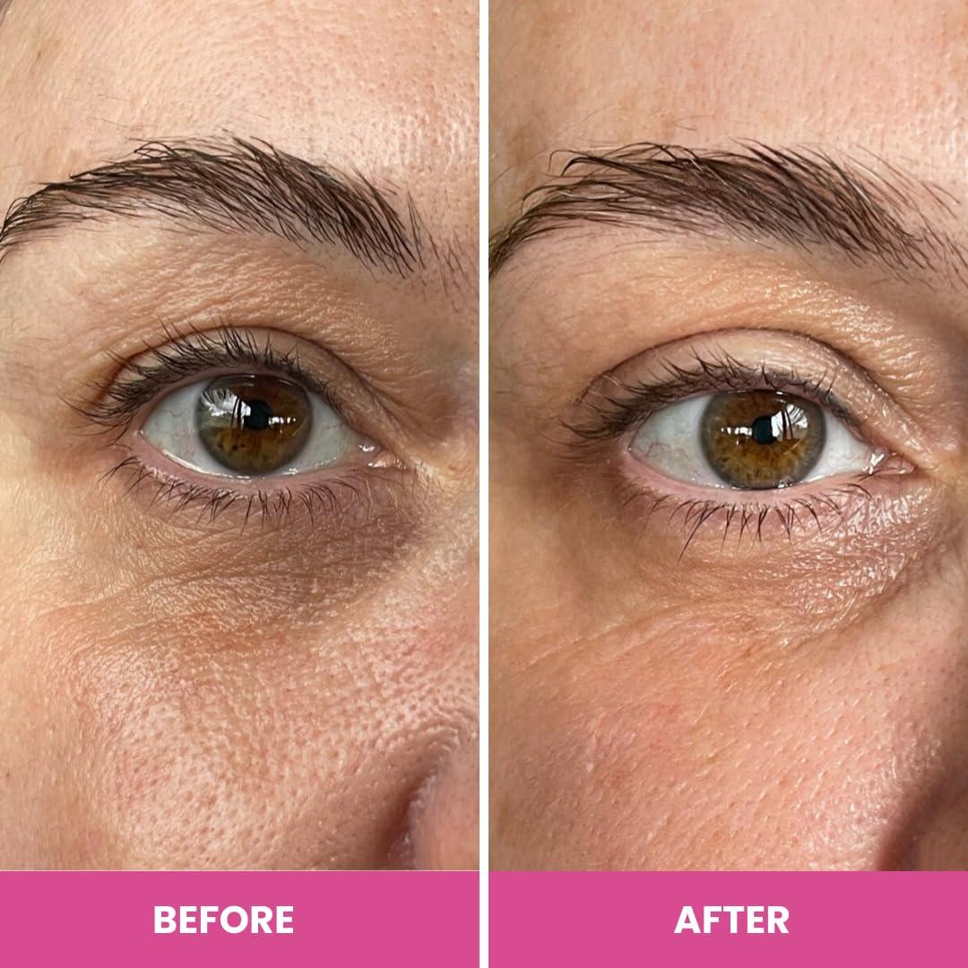image:imagePRIME PROMETICS PrimeEyes Hydrate Under Eye Cream for Mature Women Hydrating Eye Cream for Dark Circles and Wrinkle Repair Soft Glowing amp Healthy Under Eyes