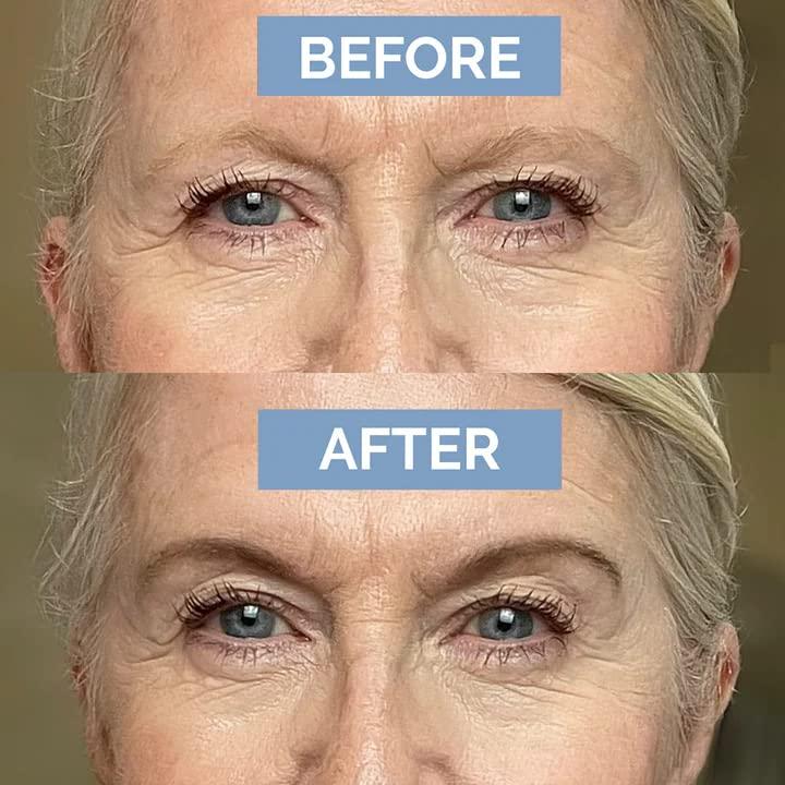 image:imagePrime Prometics PrimeBrow Complete 3in1 Eyebrow Care for Mature Women Eyebrow Mousse Tints Magic Spoolie Brush Shapes Eyebrow Growth Serum Fills Bald Spots Deep BrownDeep Brown